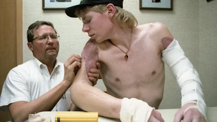 How John Thompson Survived Losing Both of His Arms