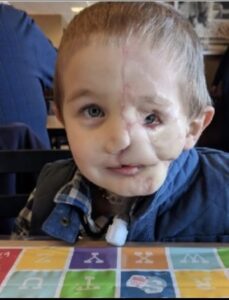 At just five years old little Ryder Wells has been through more horror than most would experience in a lifetime