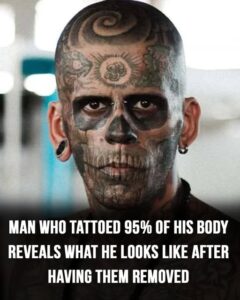 Man who tattooed 95% of his body reveals what he looks like after removing them