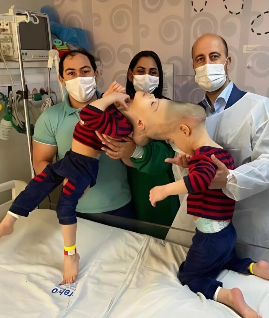 These brothers from Brazil were born with their heads fused together and had to share not only vital blood vessels but also parts of their brains. 😢 When the boys were four years old, doctors decided to separate them. 😲 The surgery lasted 23 hours and involved nearly 100 specialists. 😨 Luckily, the separation was successful, but now the brothers face developmental challenges and are relearning to speak and walk. 😱 Pictures showing how these extraordinary conjoined twins look after separation were shared in the first comment. 👇 👇