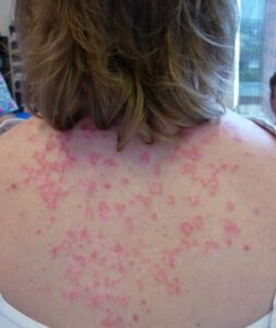 These are the consequences of sleeping with…See more