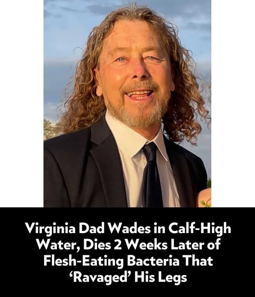 A Virginia father and pastor has died less than two weeks after being exposed to the flesh-eating bacteria Vibrio vulnificus while wading in shallow water during a family outing.