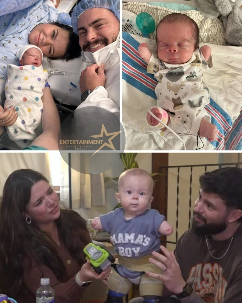 Bryson’s Miracle: The Baby Who Teaches the World About Strength Without Limbs