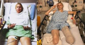 Her legs are amputated after using a common household product