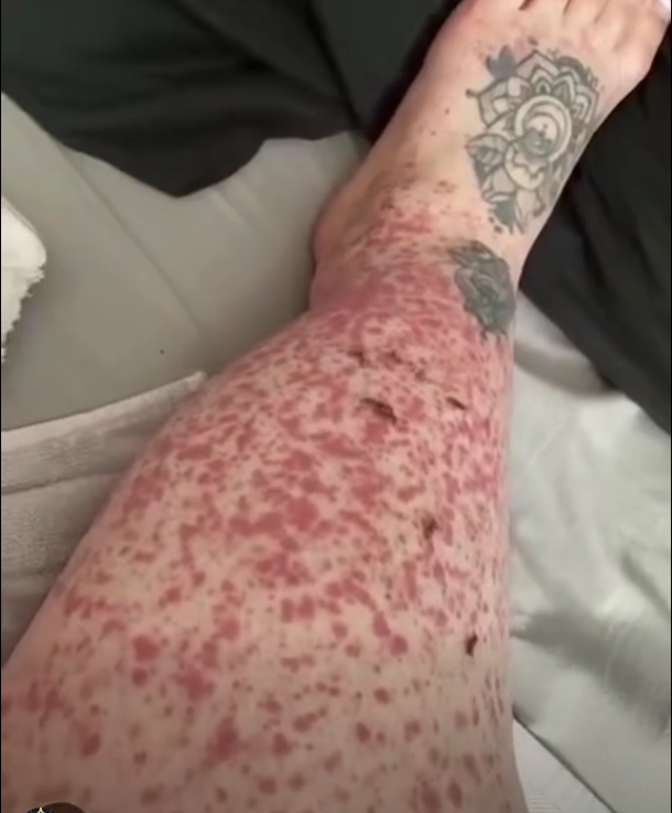 These are the consequences of sleeping with…See more