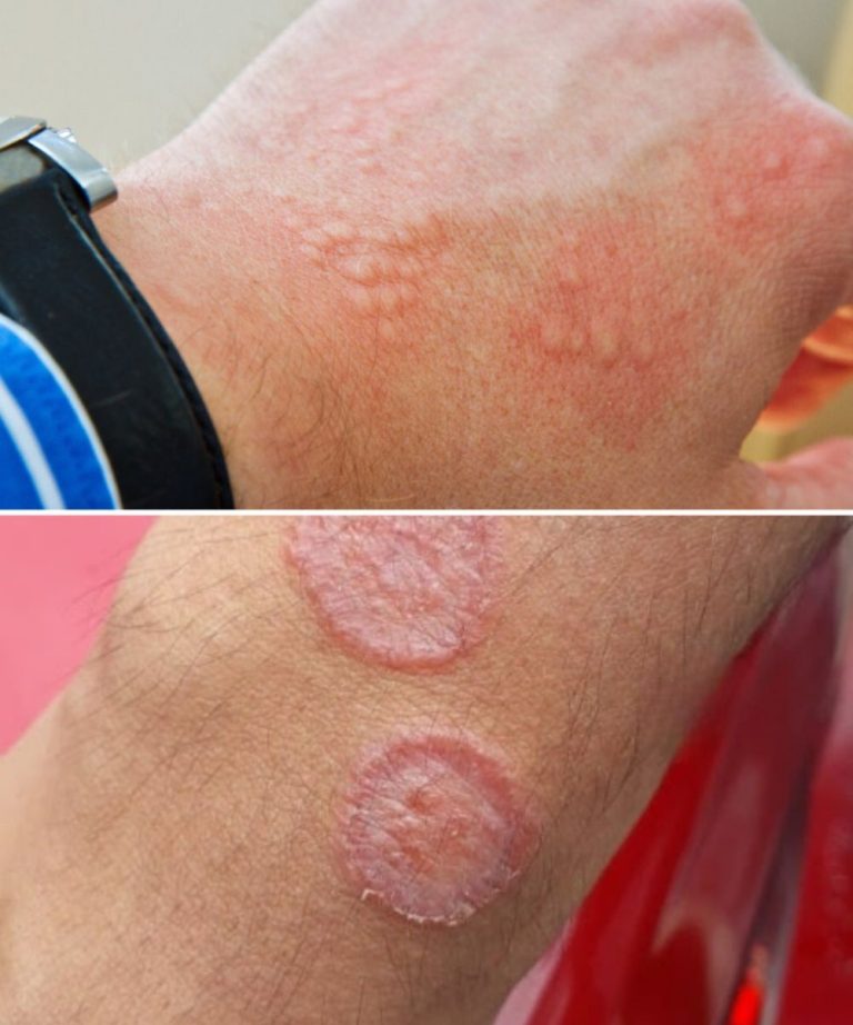 How to Reduce Skin Irritation: Causes, Remedies, and Prevention Tips