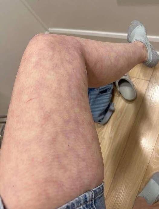 These are the consequences of sleeping with the…See more