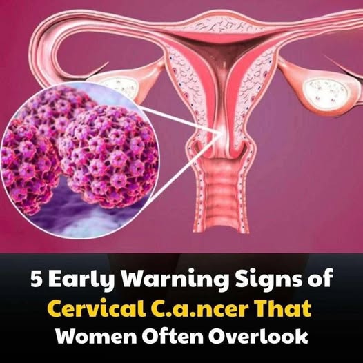 5 early warning signs of cervical cancer