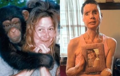 The sad story of Charla Nash, the woman whose face was ripped off by an chimpanzee