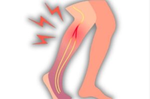 5 surprising causes of weak legs in seniors—and how to fix them!