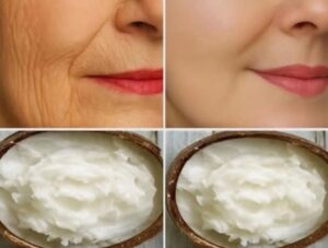 My aunt taught me how to prepare my own homemade cream to remove wrinkles and blackheads.