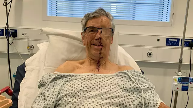 Incredible photos show first NHS 3D printed face after man’s torn apart in horrific accident