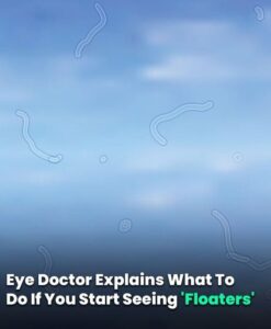 What Are Eye Floaters? Here What To Do If you Start Seeing Them, According to an Eye Doctor
