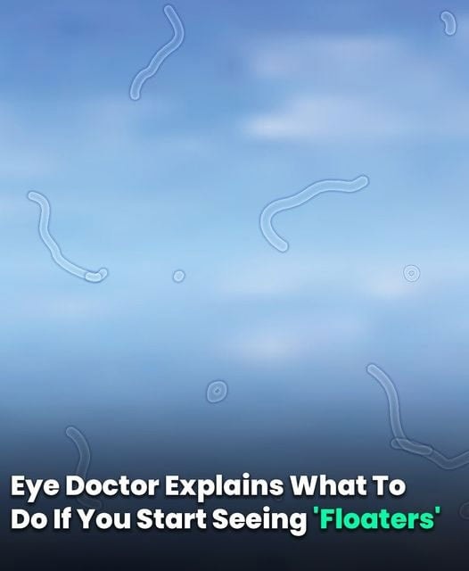 What Are Eye Floaters? Here What To Do If you Start Seeing Them, According to an Eye Doctor