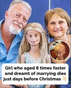 Beandri Booysen: Girl in South Africa with progeria dies