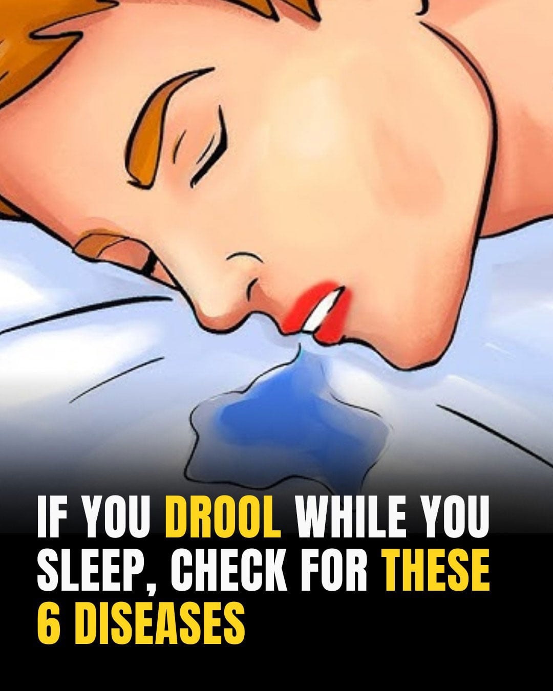 10 Reasons You’re Drooling While You Sleep and What It Could Mean