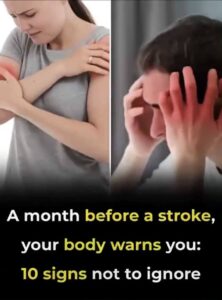 Are there any warning signs before a stroke?