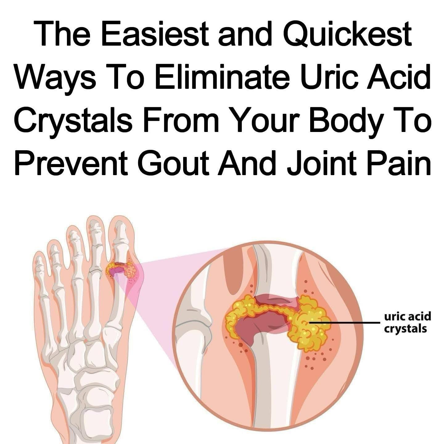 How to help naturally relieve gout and joint pain
