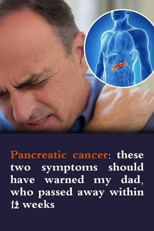 Signs of pancreatic cancer you should never ignore