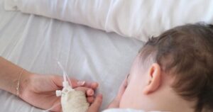 Cruel reactions force parents to remove baby’s rare birthmark