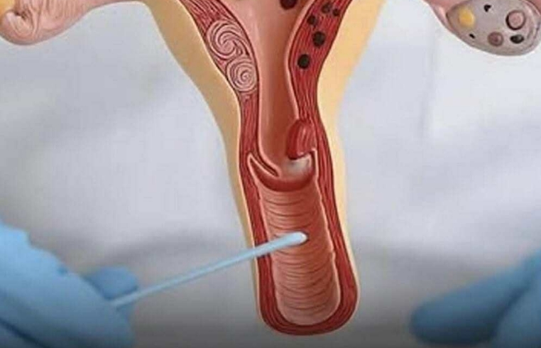 The Hidden Consequences of a S*xless Life