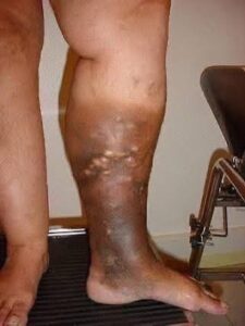 These are the first symptoms of a… See more