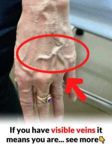 Can you see your veins through your skin? Your body may be trying to tell you THIS…
