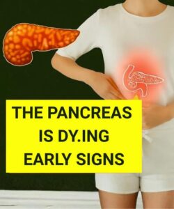 Why Back Pain Can Be a Sign of Pancreatic Canc3r
