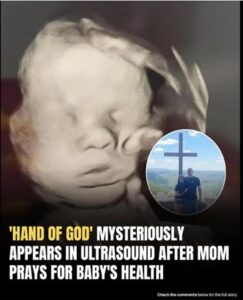 Mother sees ‘God’s hand’ holding her baby’s head in ultrasound image