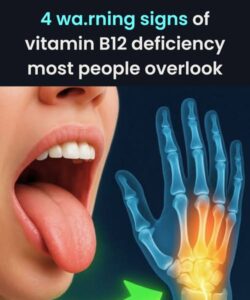 4 alarming symptoms of vitamin B12 deficiency you can’t ignore!