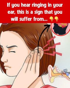 If you hear ringing in your ear, this is a sign that you will suffer from…