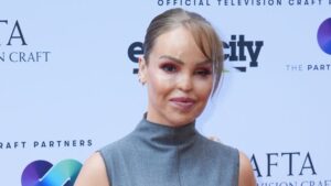 “FOR YEARS, I HID. TODAY, I SHOW THE WORLD MY SCARS AND MY STRENGTH — BECAUSE I AM MORE THAN WHAT THEY TRIED TO TAKE FROM ME.” Seventeen Years After A Horrific Acid Attack Left Katie Piper Blind In One Eye, Scarred Across Her Body, And Enduring Over 250 Surgeries, She Stepped Onto The Beach In A Bikini — And The World Stopped. Witnesses Were Frozen, One Whispering Through Tears: “She’s Not Just Surviving… She’s Reclaiming Every Piece Of Her Soul.” Social Media Erupted, Fans Calling It “The Bravest Moment Of The Decade,” While Katie Added Quietly: “I Won’t Hide Anymore. My Scars Tell My Story, My Strength Shows My Triumph.” Hundreds Of Thousands Watched, Heartbroken, Awed, And Inspired.