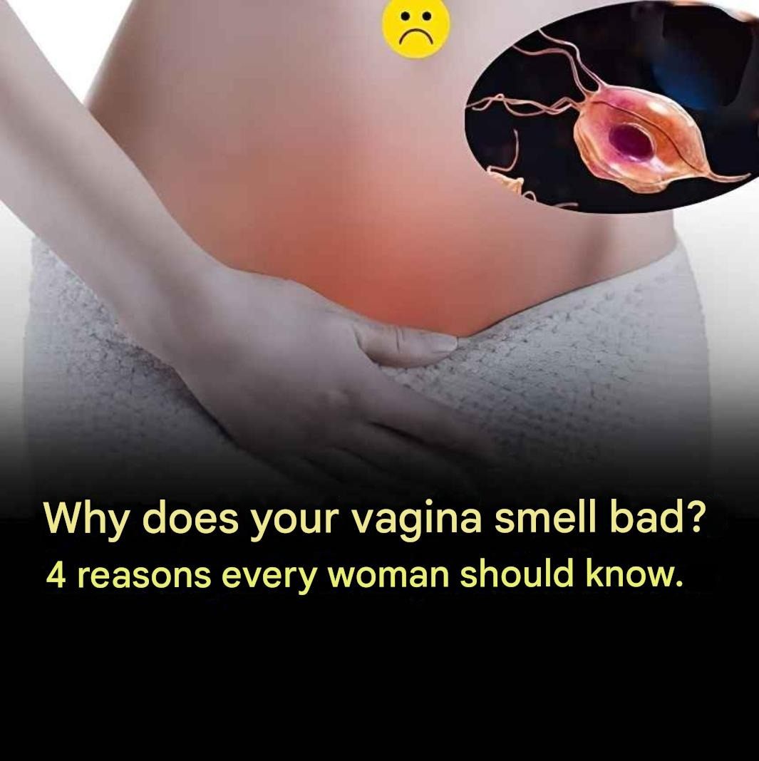 Why does your vagina smell bad? 4 reasons every woman should know.