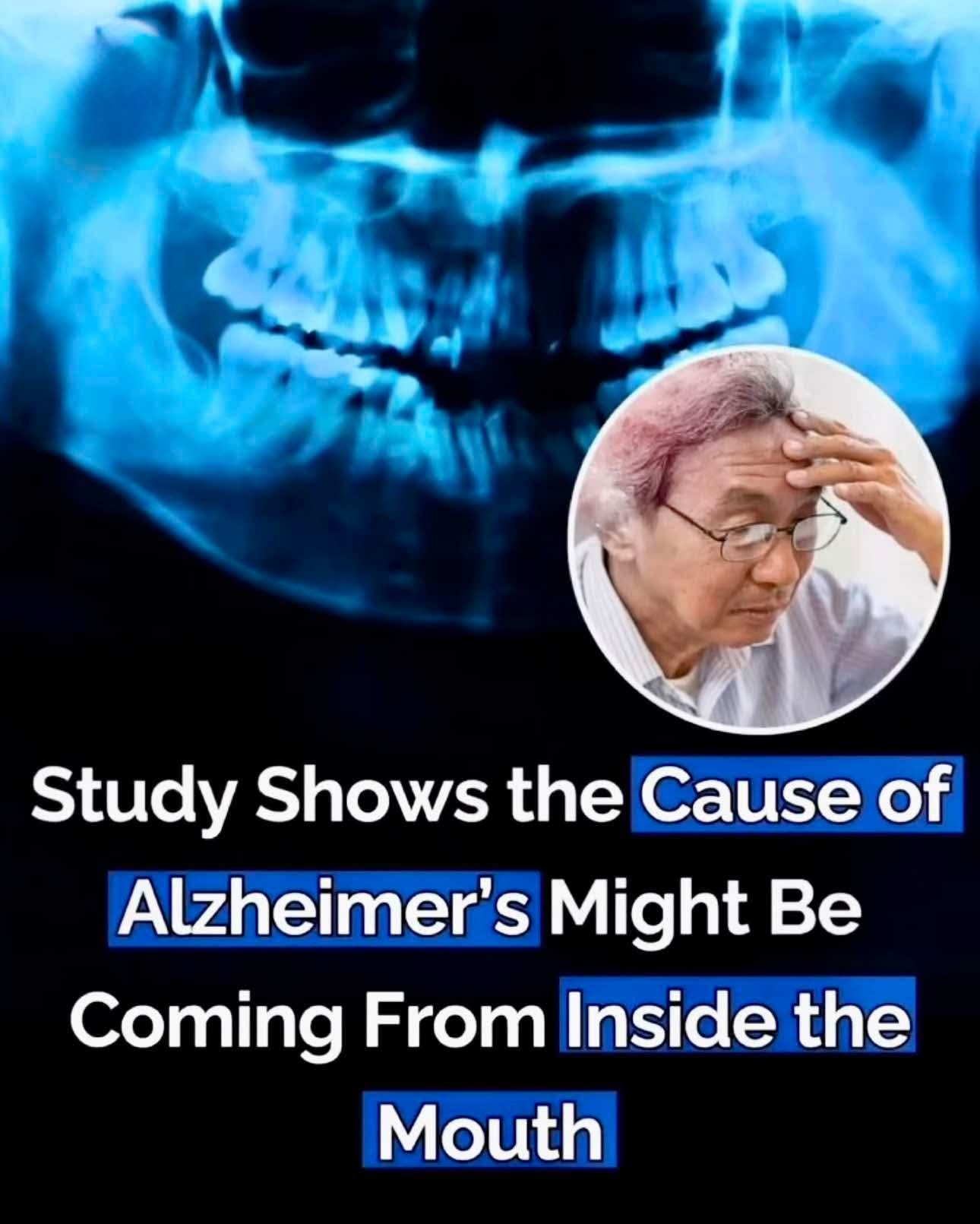The cause of Alzheimer’s may lie within your mouth