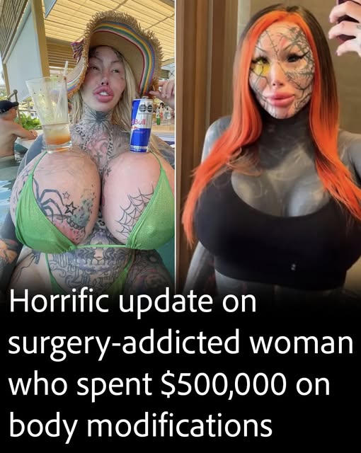 Tragic update on surgery-addicted woman who wanted to become a”forest elf”