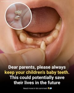 Tiny Teeth, Big Possibilities: The Promise of Stem Cells in Baby Teeth