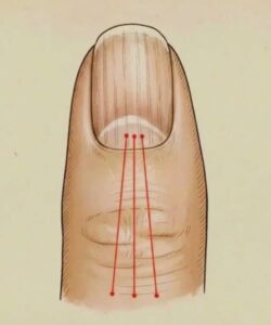 What to Eat to Reduce Nail Ridges: A Nutrition Guide for Healthier Nails