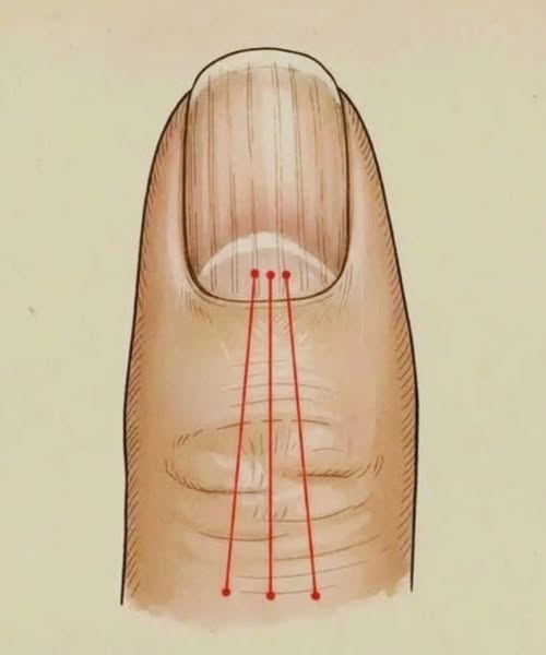 What to Eat to Reduce Nail Ridges: A Nutrition Guide for Healthier Nails