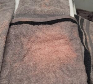 What’s Really Causing Those Stubborn Orange Towel Stains?