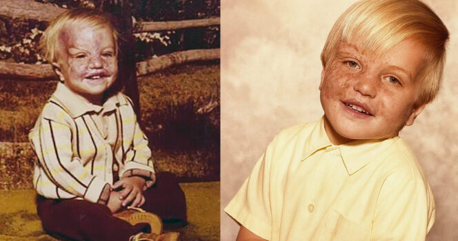 Surviving the unthinkable: Keith Edmonds’ fight for life