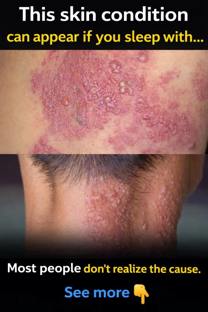 These are the consequences of sleeping with the…