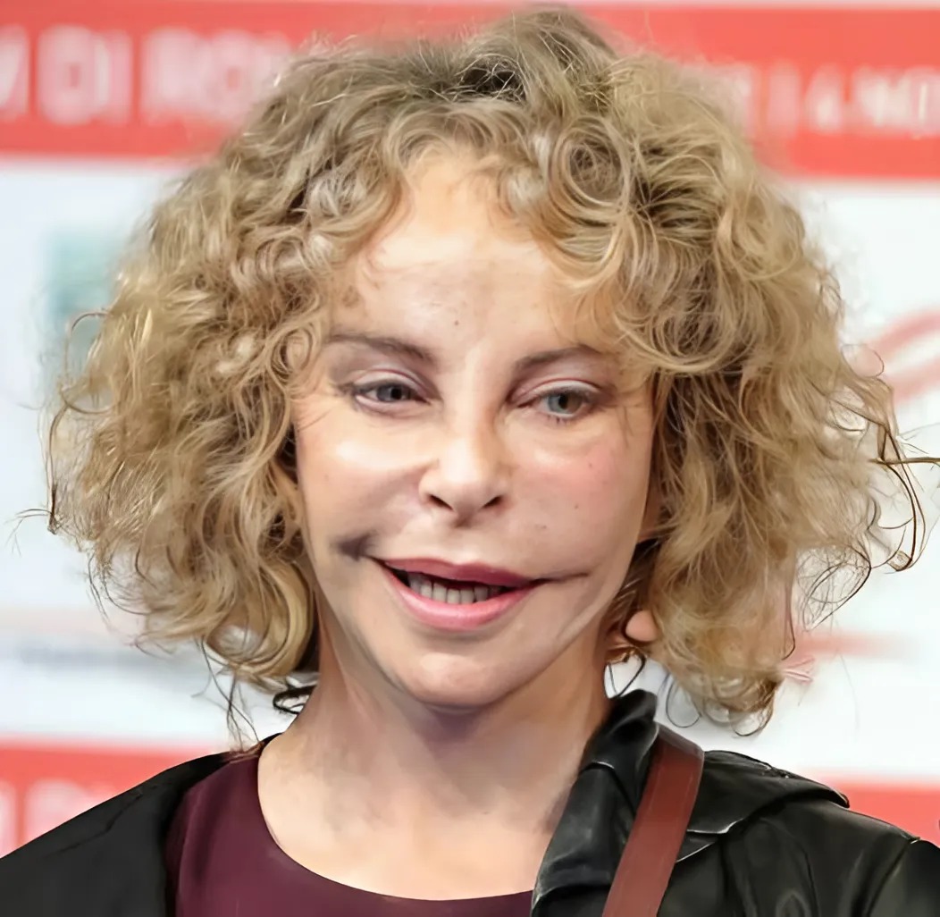 She once embodied elegance and captivated all eyes 😍. Her blue eyes made hearts melt 🥰. But time has left its mark, and in her quest for eternal youth, the actress turned to plastic surgery. Unfortunately, instead of preserving her charm, these procedures had the opposite effect 😢. Today, even her most devoted fans struggle to recognize her 😲. Discover what she looked like before plastic surgery in the comments. 👇👇👇