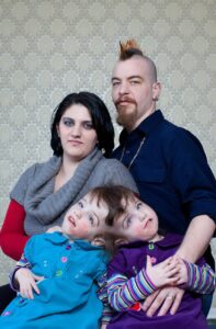 These conjoined twin sisters recently turned 18 😲 They were born with fused heads and partially joined brains 😱 Thanks to that, they can feel, hear, see, and even think for one another. 😲 If one is tickled, the other laughs. If one drinks juice, the other tastes it. 🤔 How the sisters look today was shown in the first comment 👇👇