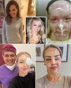 “MY BODY IS GROWING WEAKER DAY BY DAY” — KATIE PIPER LEAVES FANS DEEPLY MOVED AS SHE OPENS UP ABOUT HER CURRENT HEALTH, REVEALING A SETBACK SO SERIOUS IT HAS FORCED HER TO LET GO OF A LONG-HELD DREAM. In a moment of raw, unfiltered honesty that has sent ripples of emotion through her community, the activist and presenter has shared the painful reality of a physical decline that even her legendary willpower cannot overcome. After years of unimaginable pain, countless surgeries, and a level of resilience that has inspired millions, Katie admits there are now days when her body simply can no longer keep up with her fierce determination. What makes this revelation so powerful is that she isn’t speaking to seek sympathy; she is speaking to redefine what it means to be strong. According to those following her journey, this decision to step back from a cherished goal isn’t a story of giving up—it is a profound act of choosing life, health, and self-compassion over the pressure to constantly “push through.” Her words serve as a haunting yet beautiful reminder that slowing down is not a failure, and that the courage to let go of a planned future can lead to a deeper peace with the present. As she navigates this new chapter of survival, she is teaching us all that sometimes the greatest strength isn’t found in the struggle, but in the grace of acceptance. For anyone currently learning to make peace with a changing reality, her story has become a guiding light, proving that even when the body weakens, the spirit remains unshakable….