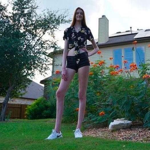17-Year-Old Phenomenon Breaks World Record Thanks to Remarkably Long Legs