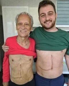 Son who donated part of his liver to his father unfortunately ends up fa… See more