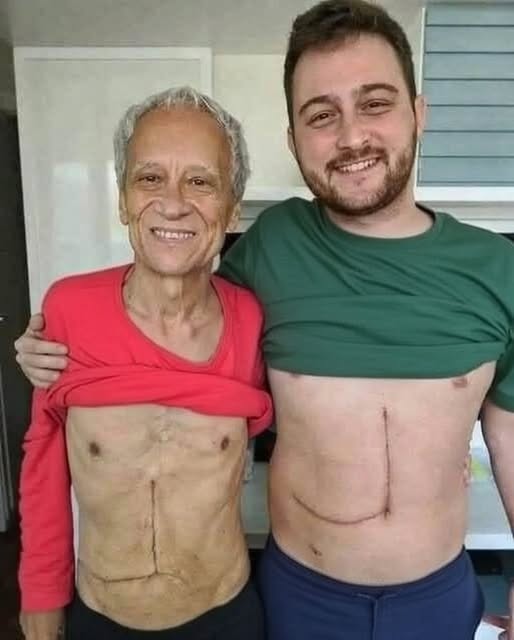 Son who donated part of his liver to his father unfortunately ends up fa… See more