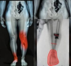 Health After Illness: Important Tips for Older Adults