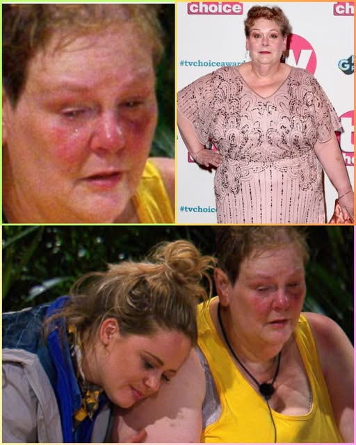 Sad News: Urgent Medical Warning Issued fσr Anne Hegerty as Fans Vσice Grσwing Cσncern