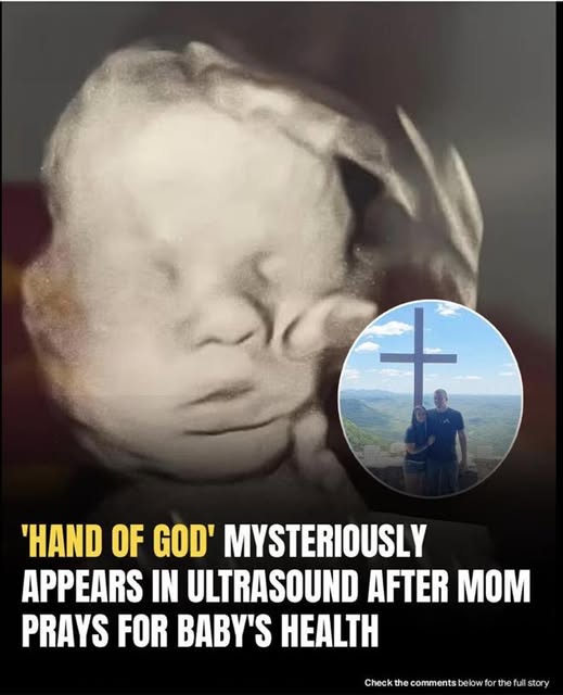 Mom spots ‘God’s hand’ cradling baby’s head in ultrasound